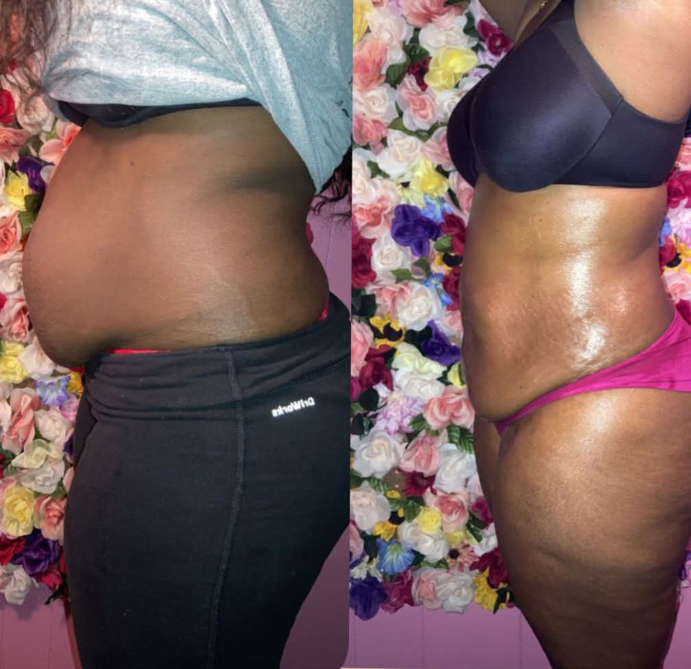 Honey Beauty client result